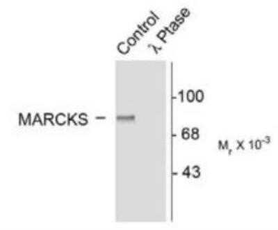 Western Blot: MARCKS [p Ser152, p Ser156] Antibody [NB500-140]